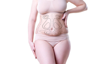 Which Type Of Tummy Tuck Is Right For Me?